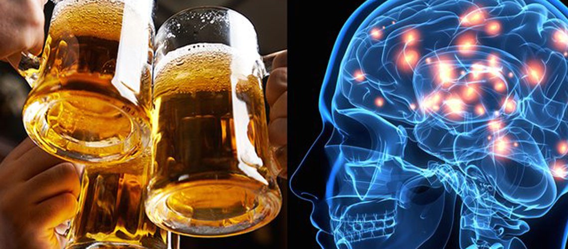 La cerveza es un increíble protector cerebral (aunque no lo crean).